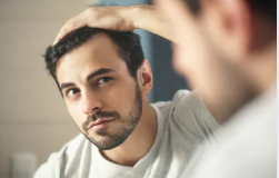 Hair Loss and Beard Trimmers